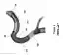 Fig. 03 - DEVICE FOR TREATING VASCULAR OCCLUSION