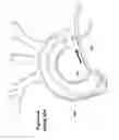 Fig. 05 - DEVICE FOR TREATING VASCULAR OCCLUSION