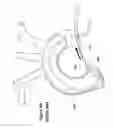 Fig. 06 - DEVICE FOR TREATING VASCULAR OCCLUSION