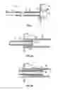Fig. 03 - Urinary catheter assembly and method