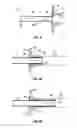 Fig. 04 - Urinary catheter assembly and method