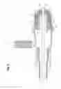 Fig. 09 - Hemostatic valve system