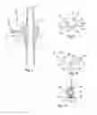 Fig. 05 - Ureteral Catheter Connector Adapter