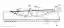 Fig. 01 - Medical lead anchoring