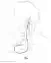 Fig. 02 - Medical lead anchoring