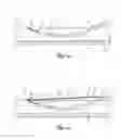 Fig. 09 - Medical lead anchoring