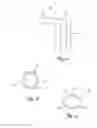 Fig. 11 - Medical lead anchoring