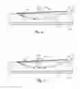 Fig. 12 - Medical lead anchoring