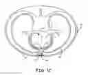 Fig. 04 - Systems and methods for deploying an implantable medical electrical lead
