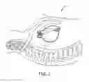 Fig. 05 - Systems and methods for deploying an implantable medical electrical lead
