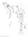 Fig. 06 - Systems and methods for deploying an implantable medical electrical lead