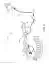 Fig. 07 - Systems and methods for deploying an implantable medical electrical lead