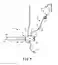 Fig. 08 - Systems and methods for deploying an implantable medical electrical lead