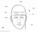 Fig. 01 - Transcutaneous neural stimulation device