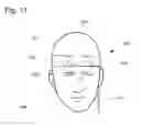 Fig. 06 - Transcutaneous neural stimulation device