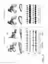 Fig. 03 - EPIDURAL STIMULATION FOR FACILITATION OF LOCOMOTION, POSTURE, VOLUNTARY MOVEMENT, AND RECOVERY OF AUTONOMIC, SEXUAL, VASOMOTOR, AND COGNITIVE FUNCTION AFTER NEUROLOGICAL INJURY