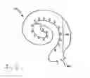 Fig. 04 - System comprising a cochlear stimulation device and a second hearing stimulation device and a method for adjustment according to a response to combined stimulation