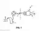 Fig. 02 - Configuring a stimulation unit of a hearing device