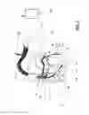 Fig. 03 - Implantable pulse generator system for vagal nerve stimulation