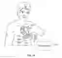 Fig. 03 - Leadless cardiac stimulation systems