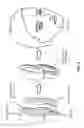 Fig. 06 - Modulating function of neural structures near the ear