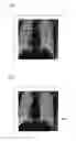 Fig. 06 - Medical image processing apparatus, treatment system, medical image processing method, and medical image processing program