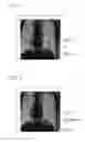 Fig. 07 - Medical image processing apparatus, treatment system, medical image processing method, and medical image processing program