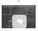 Fig. 04 - Mucosal dose control radiotherapy apparatus using magnetic fields