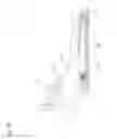 Fig. 22 - Heel locking binding system