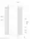 Fig. 01 - Integrated composite filter and water purification system having the same