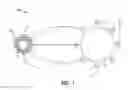 Fig. 02 - Electric field enhanced small particle filter