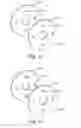 Fig. 10 - Nozzle assemblies, systems and related methods