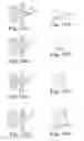 Fig. 14 - Nozzle assemblies, systems and related methods