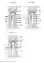 Fig. 19 - Method for manufacturing caulked assembly