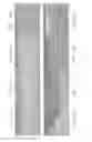 Fig. 05 - Shear knife
