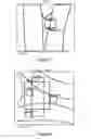 Fig. 05 - Brazing concept
