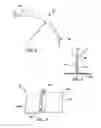Fig. 04 - Device for compressing a composite radius
