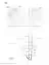 Fig. 03 - Airbag