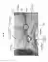 Fig. 05 - Tamper-evident reusable package closure