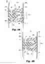 Fig. 04 - Reclosable bag having a loud sound during closing