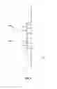 Fig. 05 - Clip reel