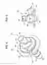 Fig. 06 - One-way valve and apparatus and method of using the valve