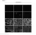 Fig. 05 - CELL SPECIFIC LABELING OF NEWLY SYNTHESIZED PROTEINS