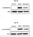 Fig. 10 - Peptide for suppressing osteoclast differentiation and use thereof
