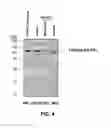 Fig. 05 - FILIP1L compositions and methods for treating cancer