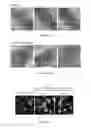 Fig. 06 - Short peptides derived from VDAC1, compositions and methods of use thereof