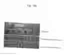 Fig. 29 - Partial region polypeptide of REIC/Dkk-3 protein