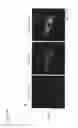 Fig. 49 - Partial region polypeptide of REIC/Dkk-3 protein