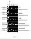 Fig. 07 - NOVEL ALTERNATIVE SPLICE TRANSCRIPTS FOR MHC CLASS I RELATED CHAIN ALPHA (MICA) AND USES THEREOF