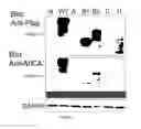 Fig. 09 - NOVEL ALTERNATIVE SPLICE TRANSCRIPTS FOR MHC CLASS I RELATED CHAIN ALPHA (MICA) AND USES THEREOF